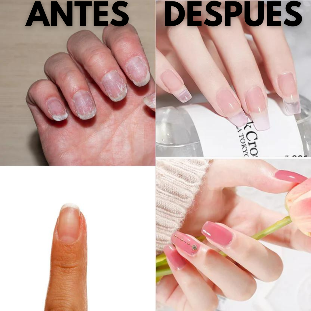 Kit de Uñas Poligel